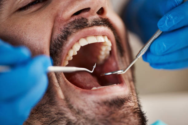 Best Dental Inlays and Onlays  in Drum Point, MD